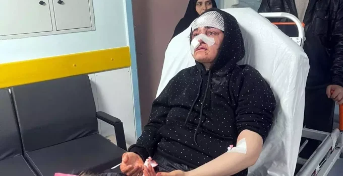 Gaziantep’te Sokak Ortasında Vahşet: Boşanma Aşamasındaki Eşini Kaldırım Taşıyla Darbetti!