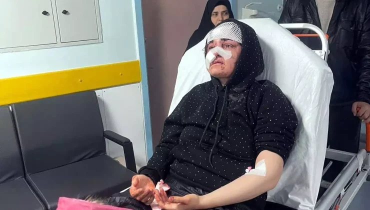 Gaziantep’te Sokak Ortasında Vahşet: Boşanma Aşamasındaki Eşini Kaldırım Taşıyla Darbetti!